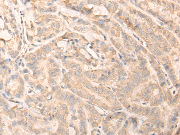 Anti-Septin 10 Rabbit Polyclonal Antibody