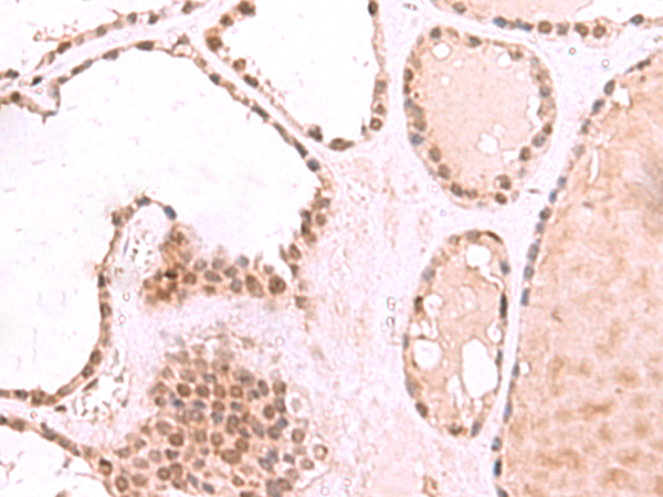 Anti-RUVBL1 Rabbit Polyclonal Antibody
