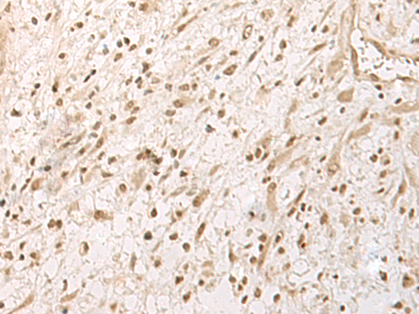 Anti-RRP1 Rabbit Polyclonal Antibody