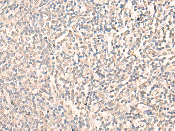 Anti-Mint3 Rabbit Polyclonal Antibody