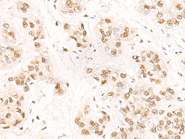 Anti-SF3A3 Rabbit Polyclonal Antibody