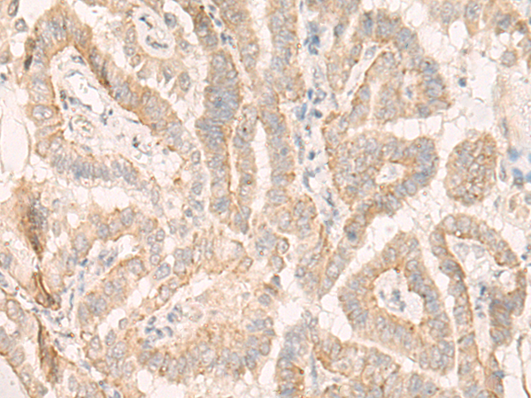 Anti-SHMT2 Rabbit Polyclonal Antibody