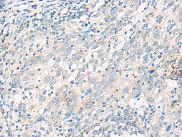 Anti-AOAH Rabbit Polyclonal Antibody