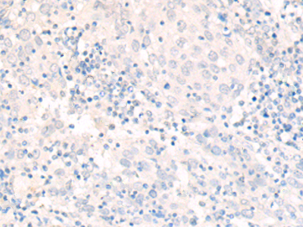 Anti-FXR2 Rabbit Polyclonal Antibody