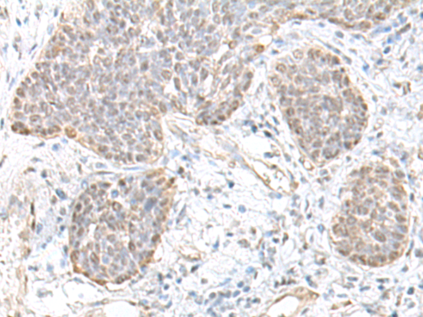 Anti-Transcription Factor 25 Rabbit Polyclonal Antibody