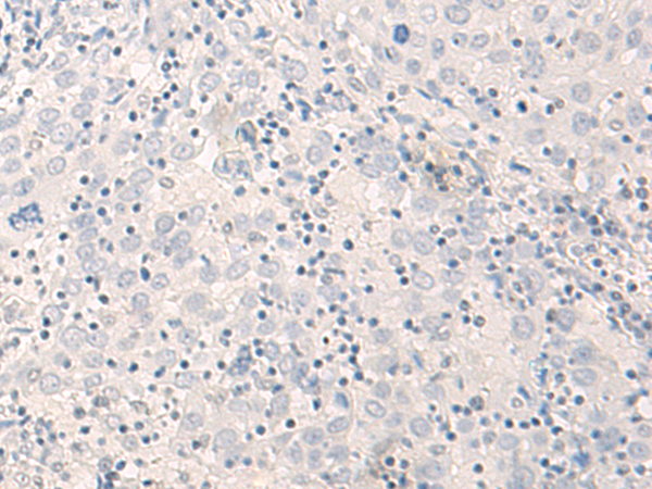 Anti-Thimet Oligopeptidase Rabbit Polyclonal Antibody