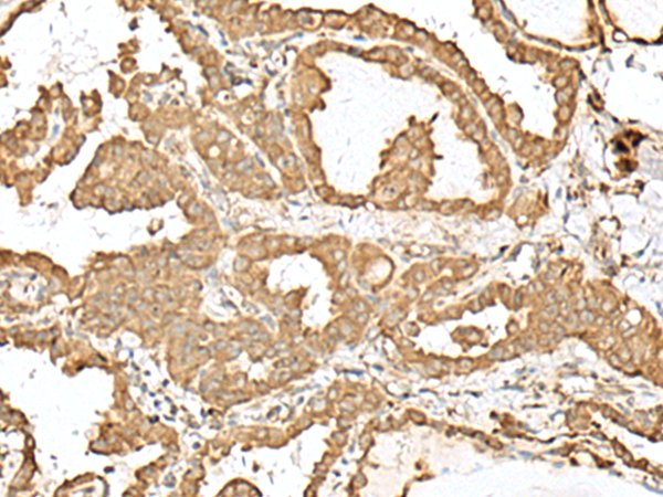 Anti-STT3A Rabbit Polyclonal Antibody