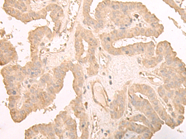 Anti-HOOK2 Rabbit Polyclonal Antibody