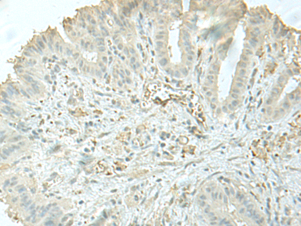 Anti-C8orf4 Rabbit Polyclonal Antibody