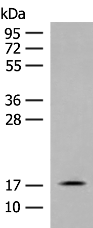 Anti-RPS25 Rabbit Polyclonal Antibody