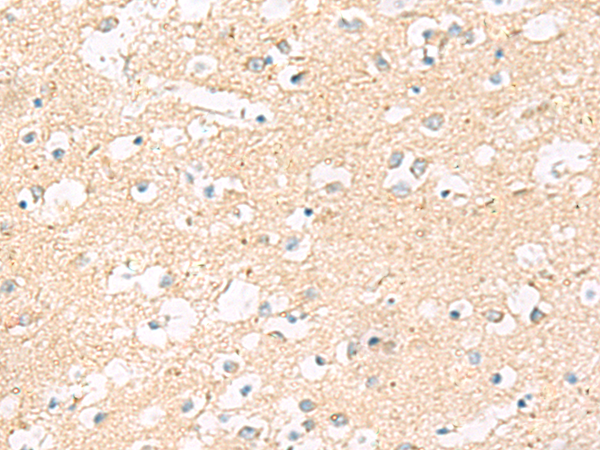 Anti-MRPL20 Rabbit Polyclonal Antibody