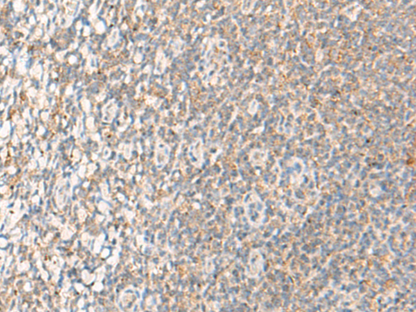 Anti-RNF5 Rabbit Polyclonal Antibody