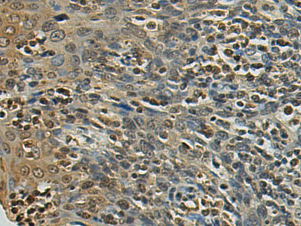 Anti-RPL17 Rabbit Polyclonal Antibody