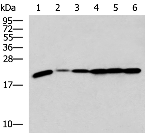 Anti-RPL17 Rabbit Polyclonal Antibody