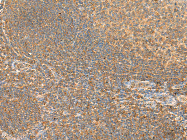 Anti-Rac3 Rabbit Polyclonal Antibody