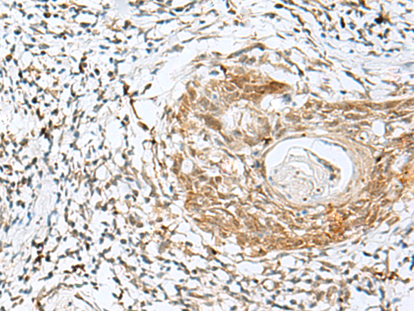 Anti-NXNL1 Rabbit Polyclonal Antibody