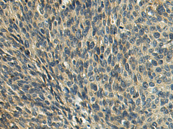 Anti-GSTZ1 Rabbit Polyclonal Antibody