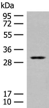 Anti-TPMT Rabbit Polyclonal Antibody