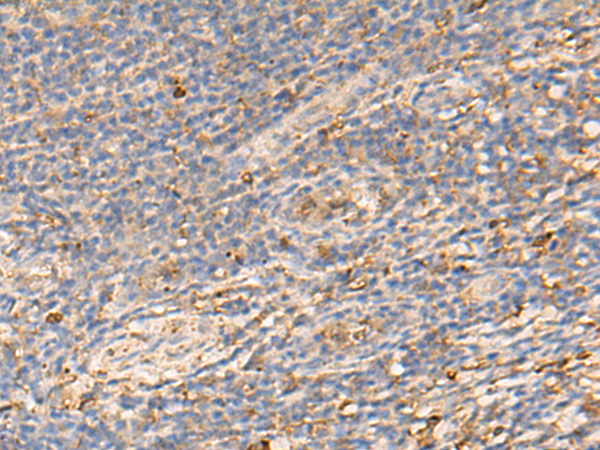 Anti-PDIA5 Rabbit Polyclonal Antibody