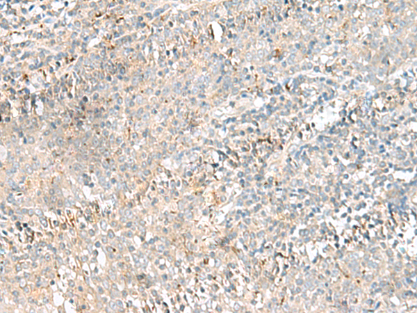 Anti-CTRB1 Rabbit Polyclonal Antibody