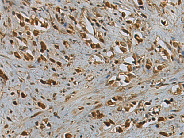 Anti-PSMA1 Rabbit Polyclonal Antibody