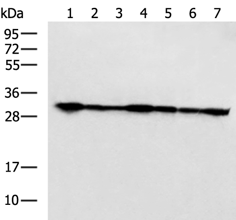 Anti-PSMA1 Rabbit Polyclonal Antibody