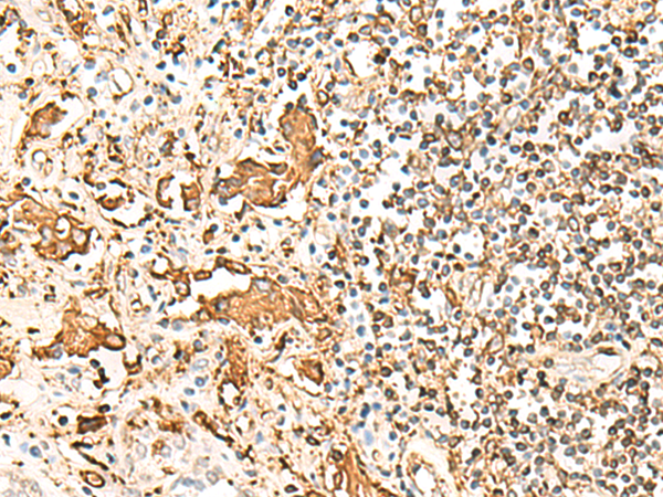 Anti-HLA DRB1 Rabbit Polyclonal Antibody