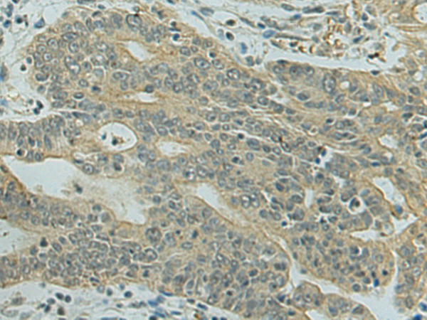 Anti-eIF4A2 Rabbit Polyclonal Antibody