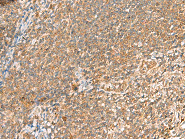 Anti-SCRN2 Rabbit Polyclonal Antibody