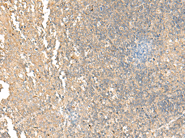 Anti-NARS1 Rabbit Polyclonal Antibody