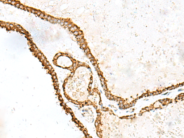 Anti-ERp72 Rabbit Polyclonal Antibody