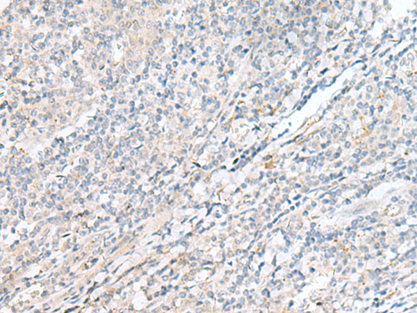 Anti-POMGNT1 Rabbit Polyclonal Antibody