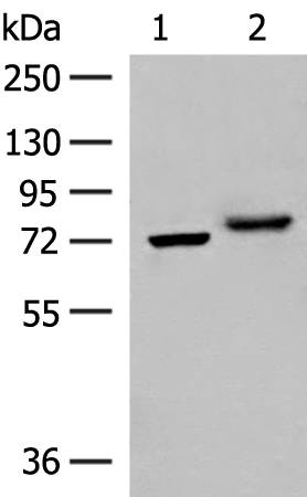 Anti-POMGNT1 Rabbit Polyclonal Antibody
