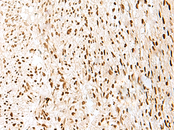 Anti-PRPF3 Rabbit Polyclonal Antibody