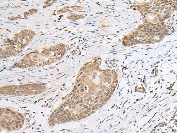 Anti-CALCOCO1 Rabbit Polyclonal Antibody
