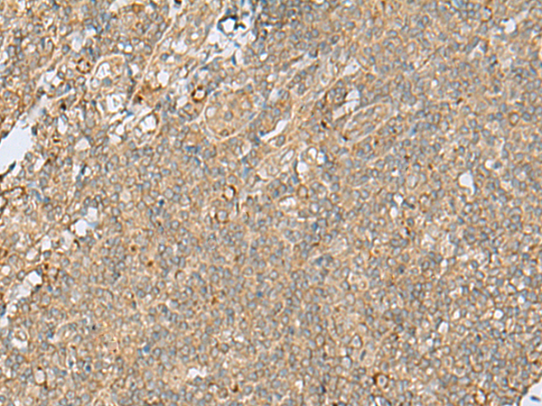 Anti-TPR Repeat Protein 12 Rabbit Polyclonal Antibody