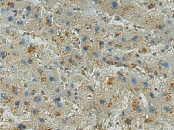 Anti-TPR Repeat Protein 14 Rabbit Polyclonal Antibody
