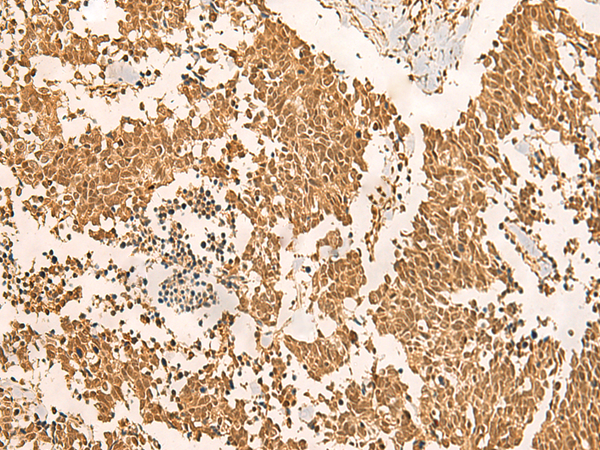 Anti-EFTUD2 Rabbit Polyclonal Antibody
