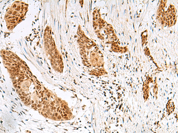 Anti-RPP14 Rabbit Polyclonal Antibody