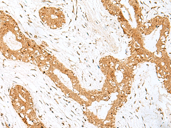 Anti-GOLGA7 Rabbit Polyclonal Antibody