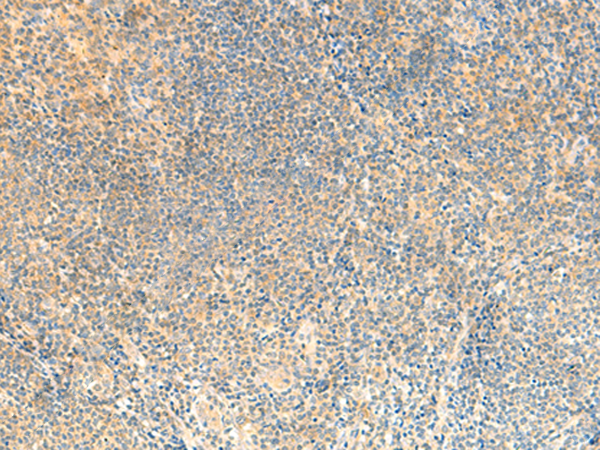 Anti-RNF24 Rabbit Polyclonal Antibody