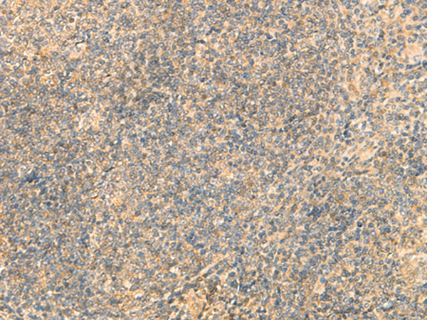 Anti-IFT22 Rabbit Polyclonal Antibody