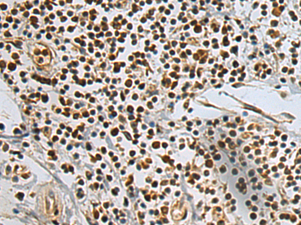Anti-PSMB2 Rabbit Polyclonal Antibody