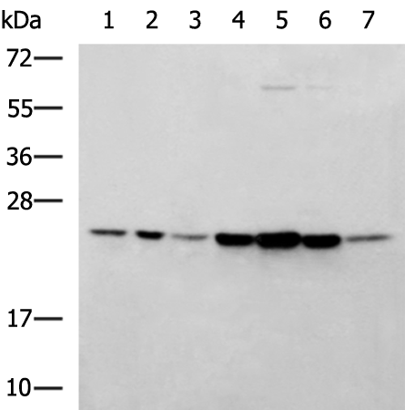 Anti-PSMB2 Rabbit Polyclonal Antibody