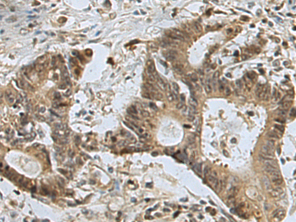 Anti-RPL13 Rabbit Polyclonal Antibody