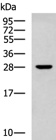 Anti-RPL13 Rabbit Polyclonal Antibody