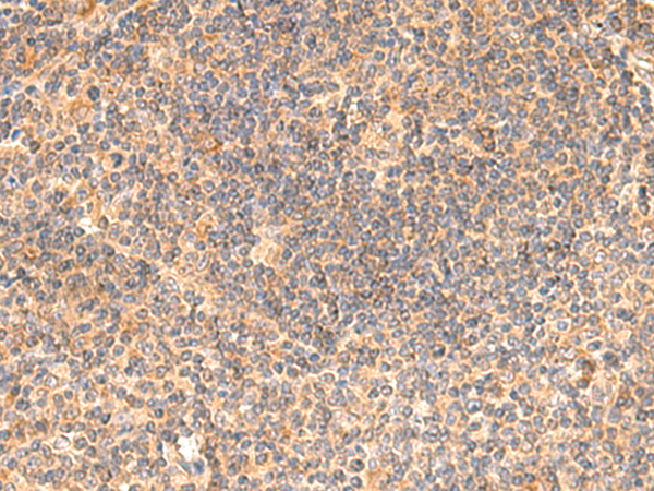 Anti-eIF3K Rabbit Polyclonal Antibody