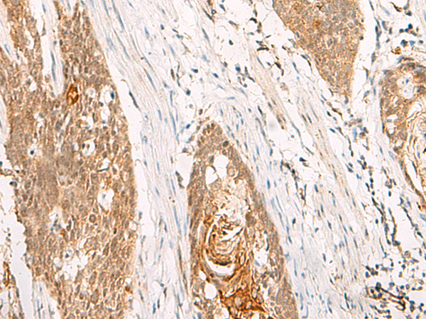 Anti-THNSL1 Rabbit Polyclonal Antibody