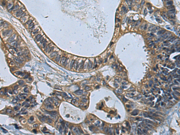 Anti-ATP6V1D Rabbit Polyclonal Antibody