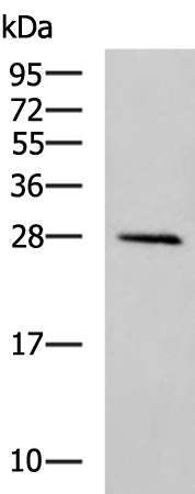 Anti-ATP6V1D Rabbit Polyclonal Antibody